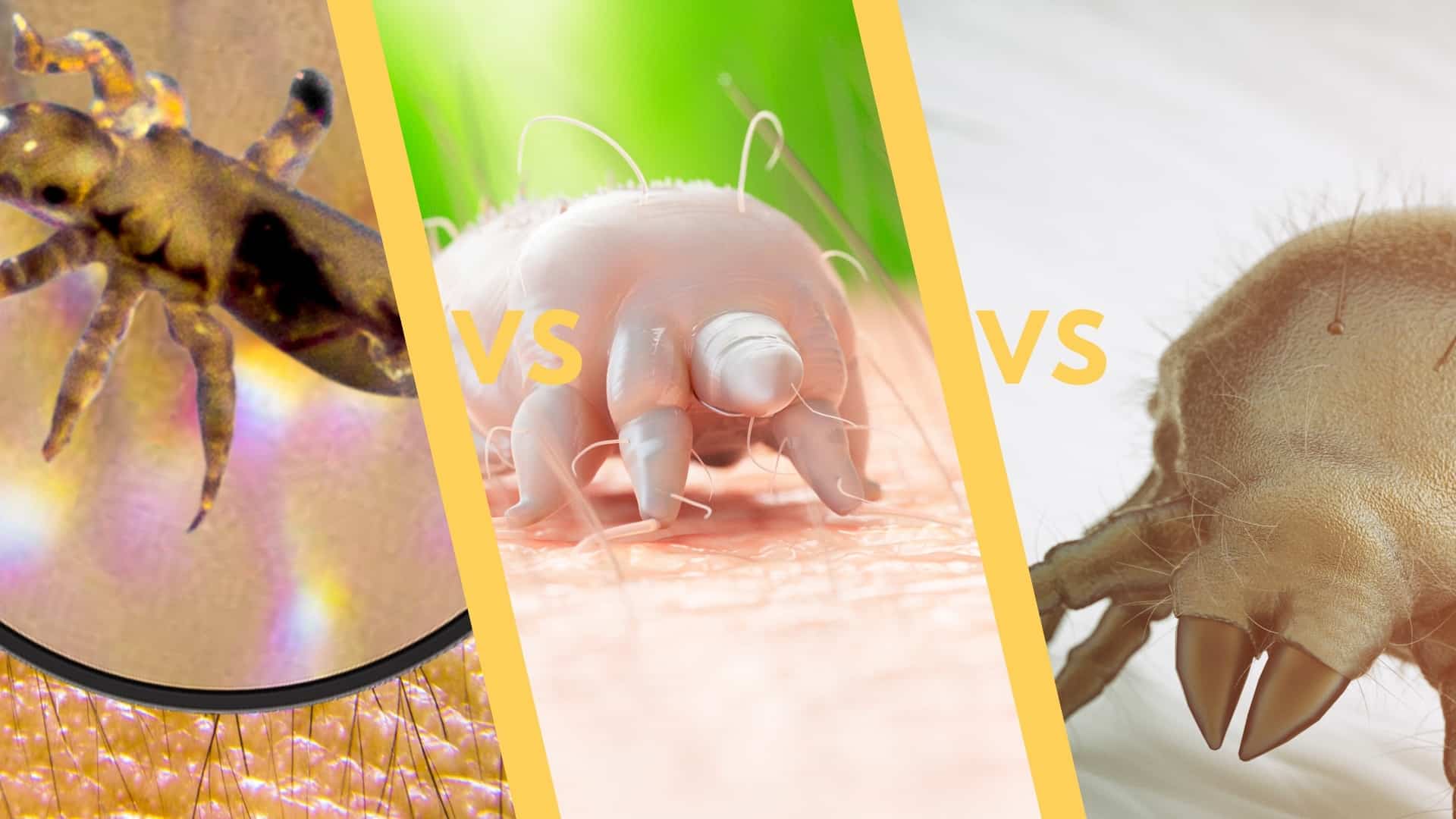 dust mites vs kuto vs scabies vs bed bugs